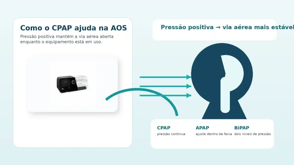  Como o CPAP atua na apneia obstrutiva do sono com pressão positiva e aparelho real
